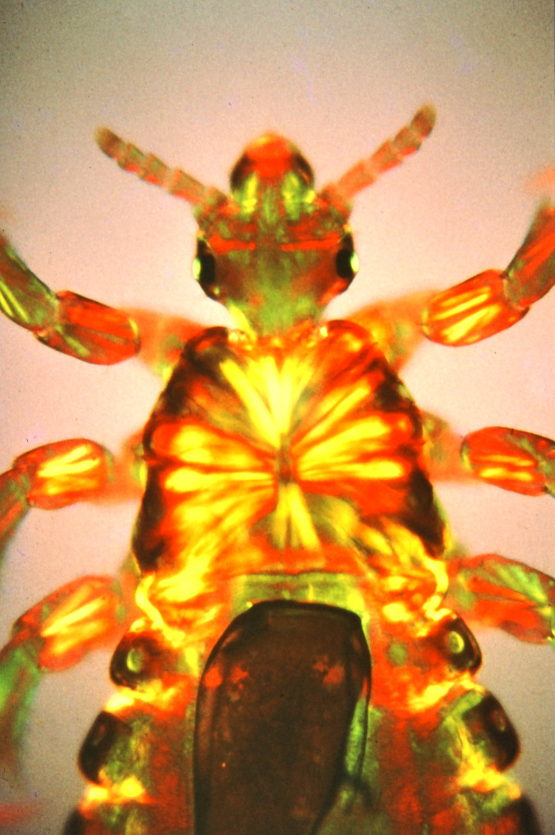 What Is Considered A Major Flea Infestation? Flea Pest Control Stevenage, Hitchin, Hertford, Hertfordshire